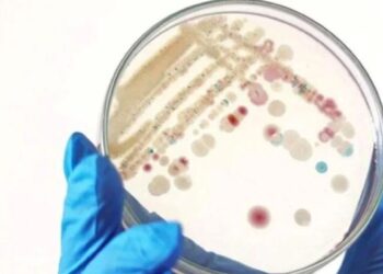 Et Yiyen Bakteri Nedir? Et Yiyen Ölümcül Bakterinin Neden Olduğu Toksik Şok Sendromunun Belirtileri Neler?