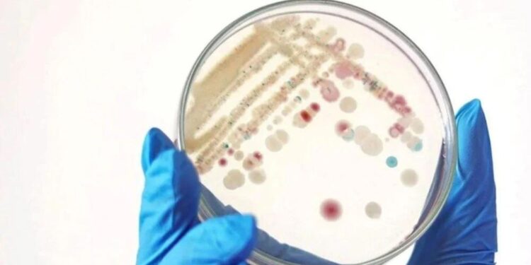 Et Yiyen Bakteri Nedir? Et Yiyen Ölümcül Bakterinin Neden Olduğu Toksik Şok Sendromunun Belirtileri Neler? Et Yiyen Bakteri Nedir? Et Yiyen Ölümcül Bakterinin Neden Olduğu Toksik Şok Sendromunun Belirtileri Neler?